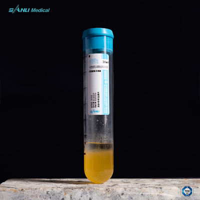 Soulagez le tube à essai de la douleur PRP 20ml ACD-A avec le GEL pour le traitement de bureautique
