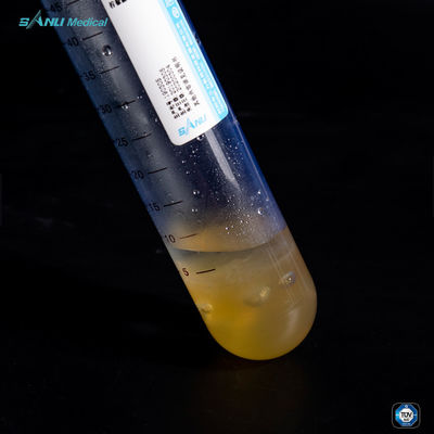 Réduisez la plaquette Rich Plasma Tube d'inflammation CHOIENT 50ml pour le traitement de bureautique